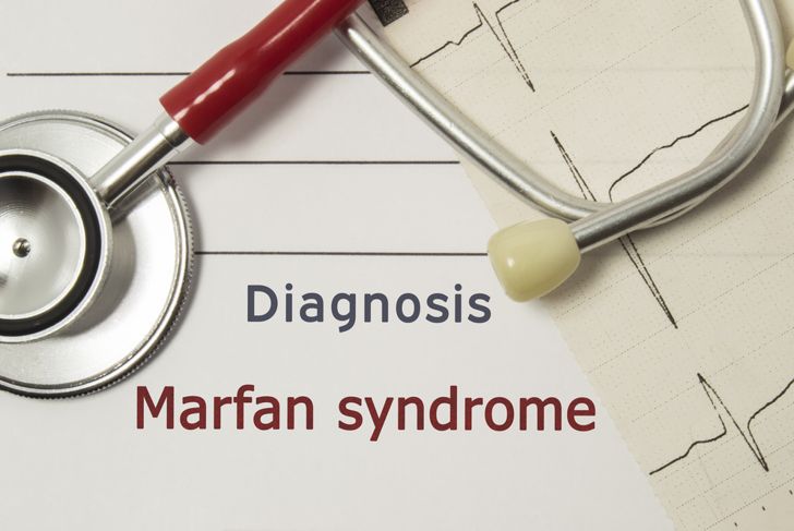 10 Symptoms of Marfan Syndrome