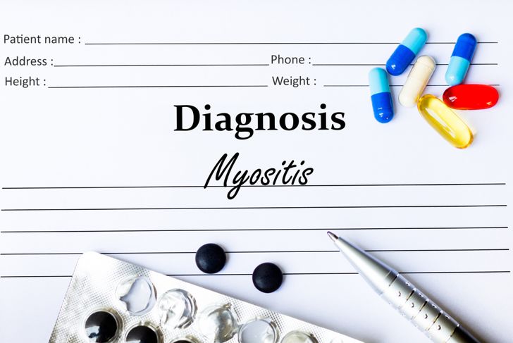 10 Symptoms of Myositis