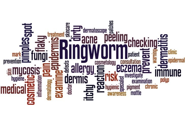 10 Symptoms of Ringworm