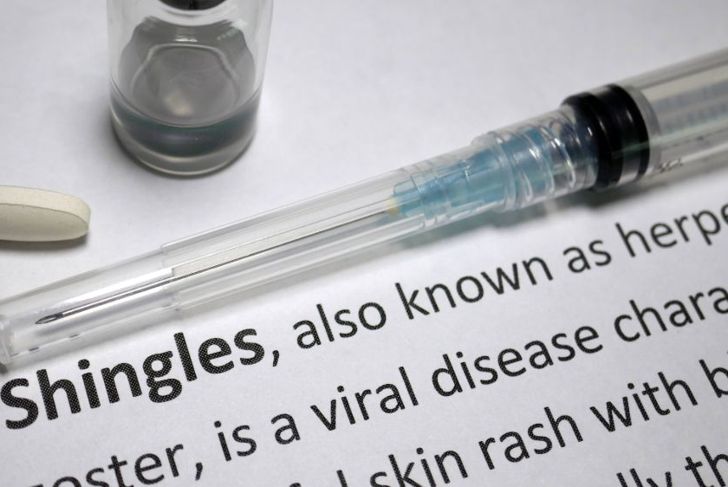 10 Symptoms of Shingles