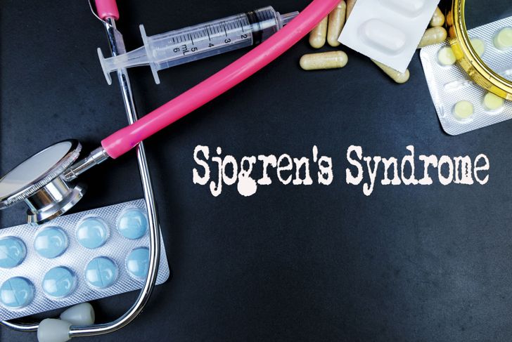 10 Symptoms of Sjogren's Syndrome
