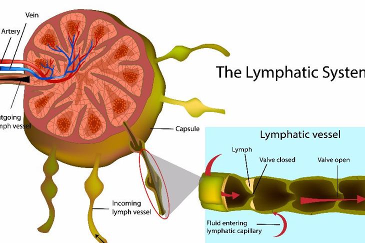 10 Treatments for Lymphoedema