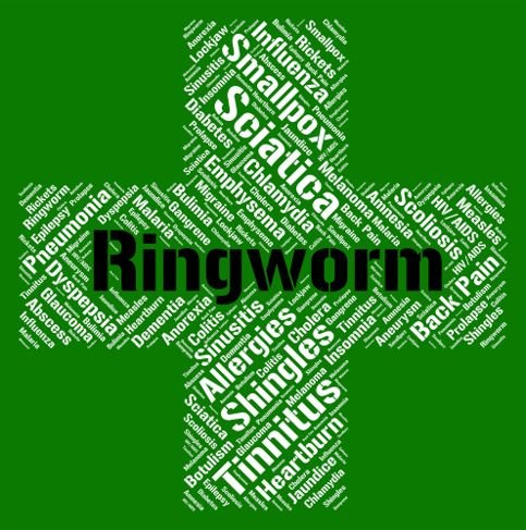 10 Treatments for Ringworm