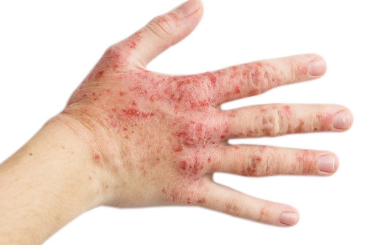 12 Causes Of Skin Rashes