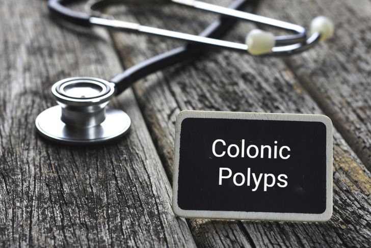9 Common Polyp Types