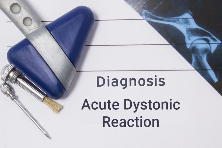 Acute Dystonic Reaction Causes, Symptoms, and Treatment
