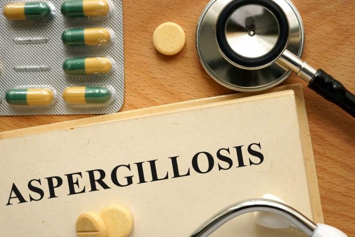 All About Aspergillosis