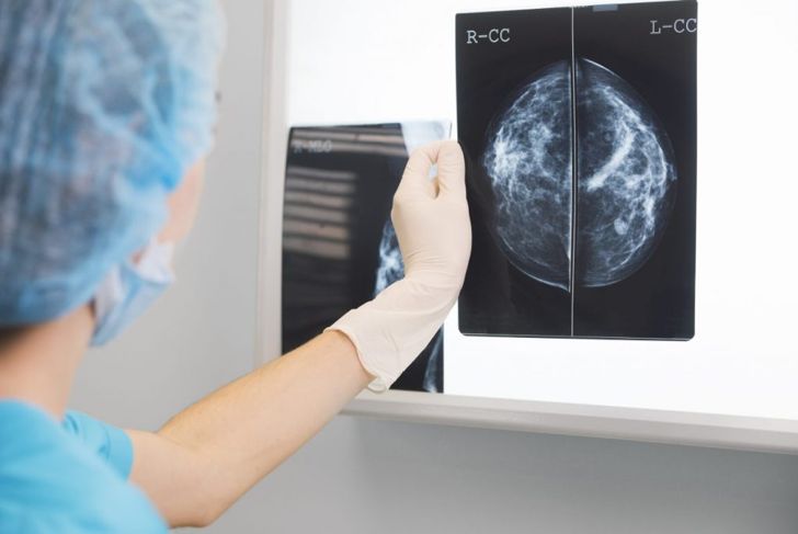 All About Fibrocystic Breast Changes