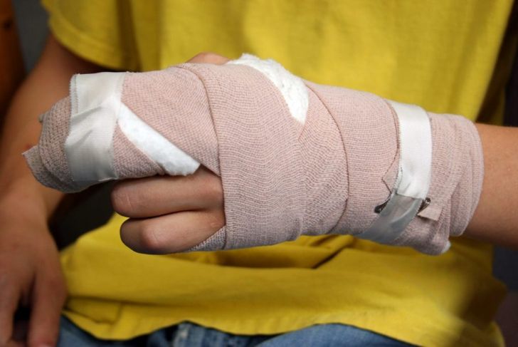 All About Finger Dislocation