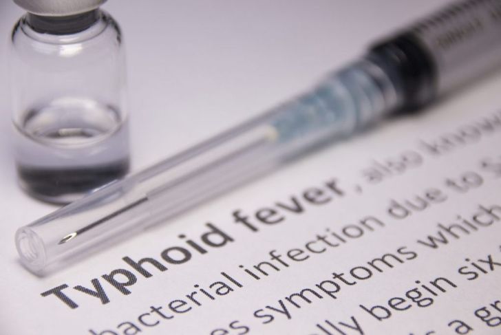 All About Typhoid Fever