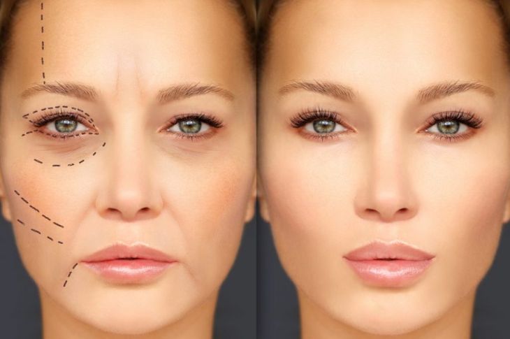 Benefits and Side Effects of Plastic Surgery