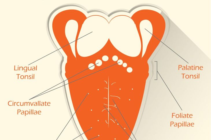 Bumps on the Tongue: Transient Lingual Papillitis