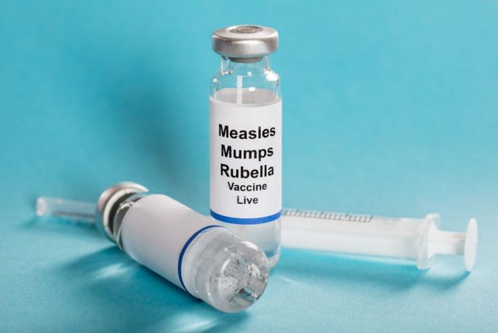 Causes and Treatments of Mumps