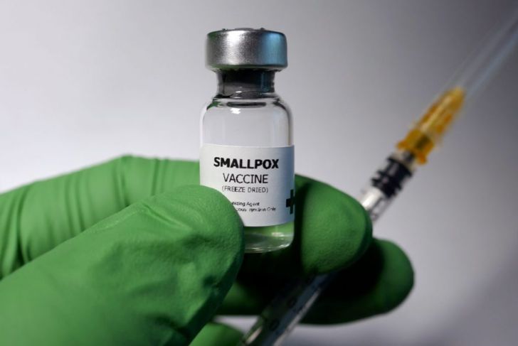 Causes and Treatments of Smallpox