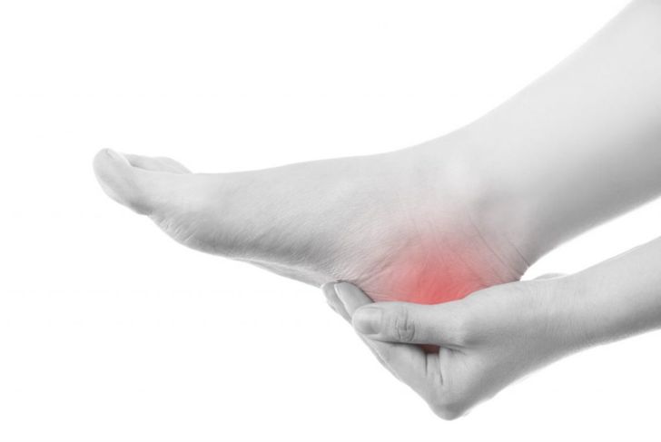 Causes of Heel Pain