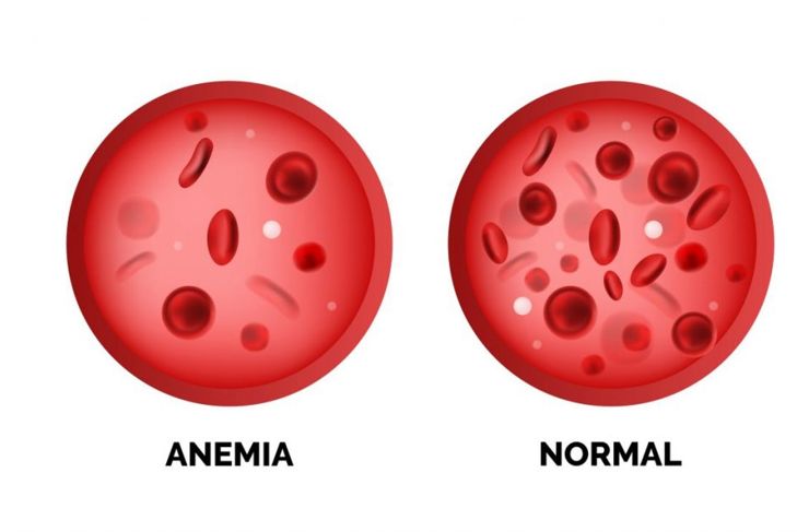 Causes of High and Low Hemoglobin Levels