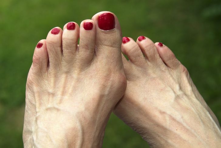Causes of Pain in the Ball of the Foot