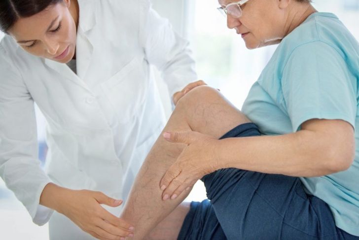 Causes, Signs, and Treatments of Thrombophlebitis