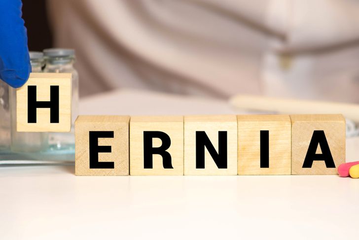 Causes, Symptoms, and Treatment of Ventral Hernias