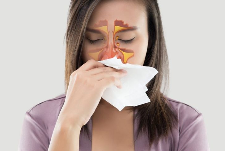 Causes Symptoms and Treatments of Chronic Sinusitis