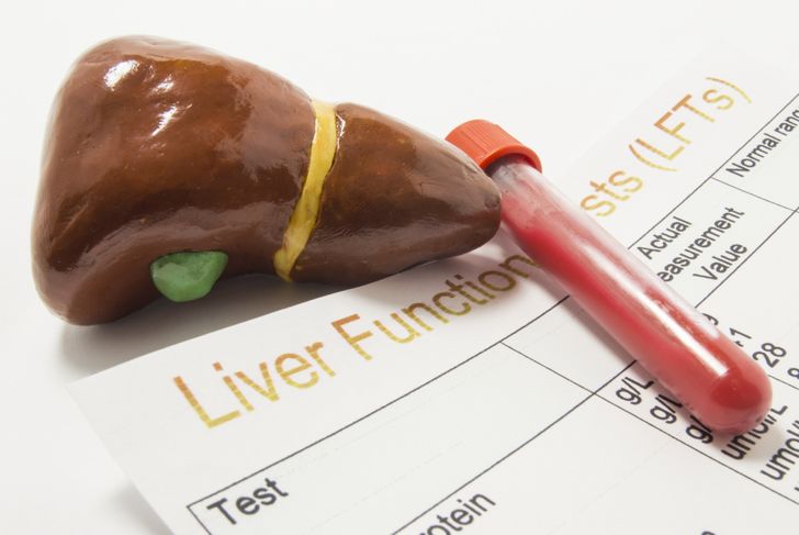 Causes, Symptoms, and Treatments of Liver Pain