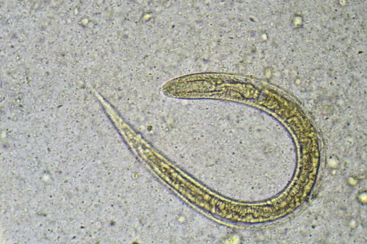 Causes, Symptoms, and Treatments of Roundworm