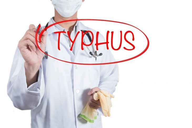 Causes, Symptoms, and Treatments of Typhus