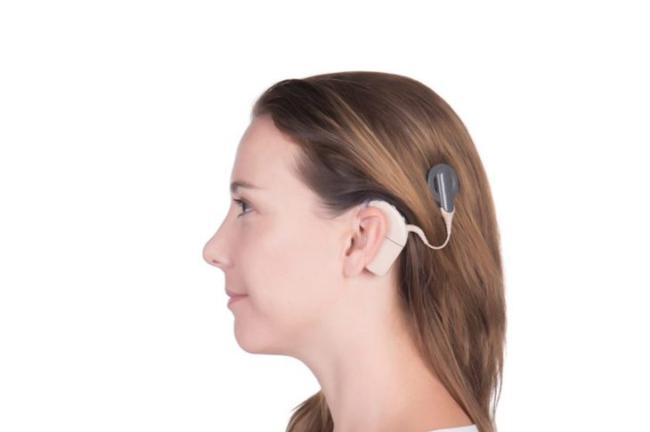 Cochlear Implants: Understanding the Benefits and Risks
