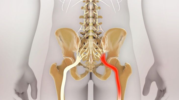 Common Causes of Hip Pain in Seniors