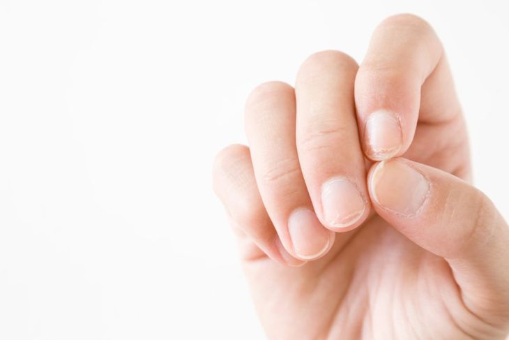 Common Health Problems Related to Fingernails