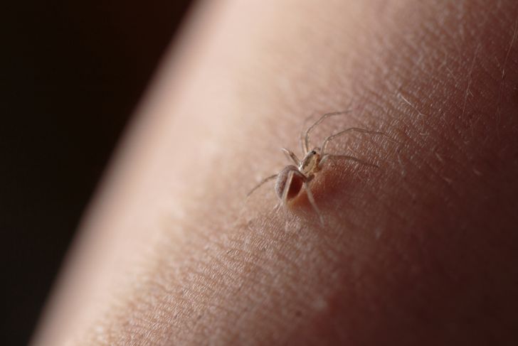 Common Symptoms, Causes, and Treatments for Spider Bites