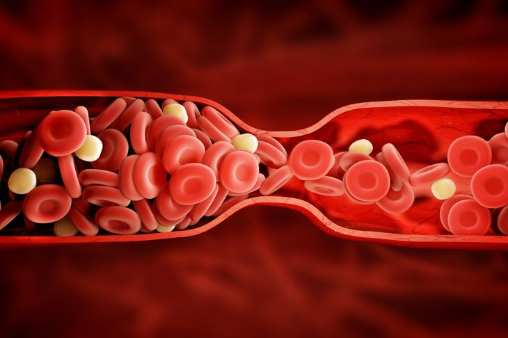 Deep Vein Thrombosis: 10 Terms You Should Know Today