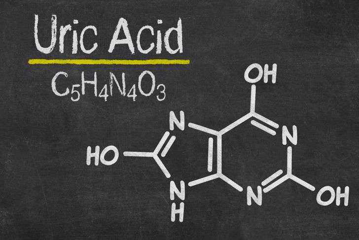 Do You Know Your Uric Acid Level?