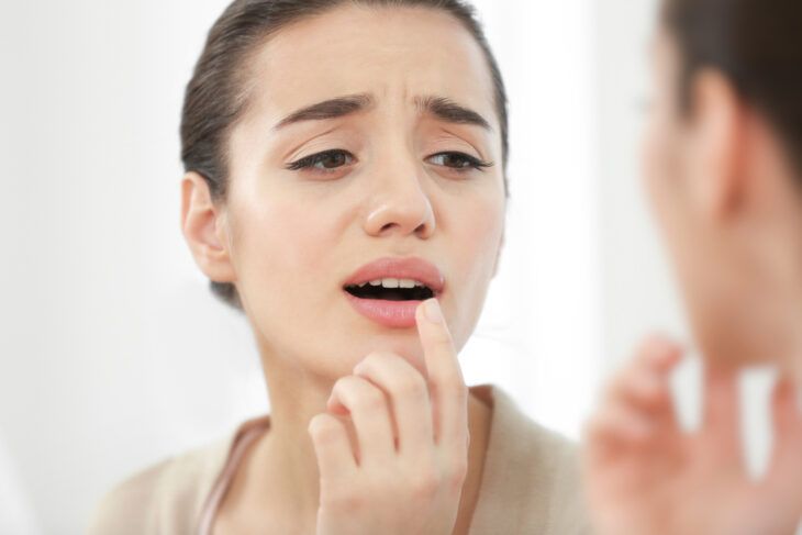 Effective Remedies for Getting Rid of Chapped Lips