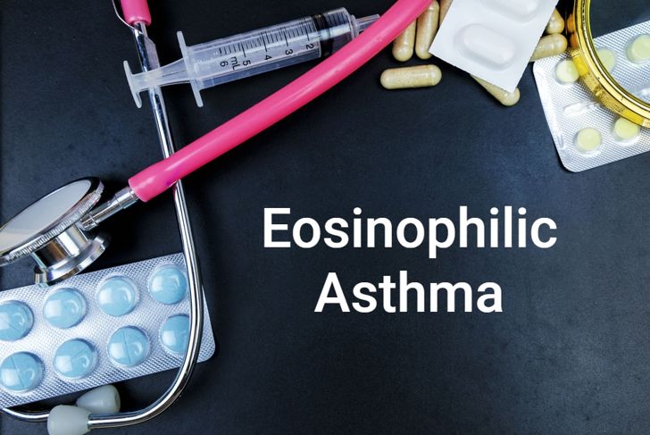 Eosinophilic Asthma: A Rare Subtype