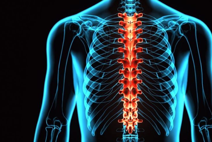 Everything You Should Know About Postural Kyphosis