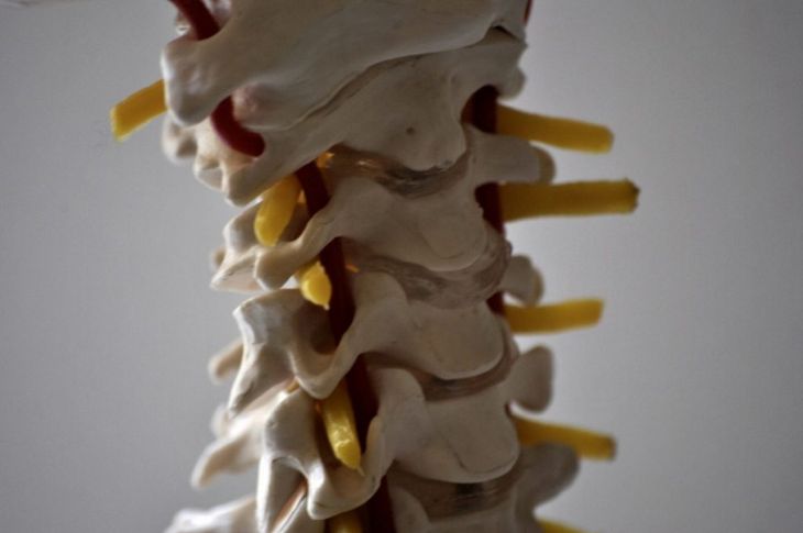 Facts About Cervical Radiculopathy