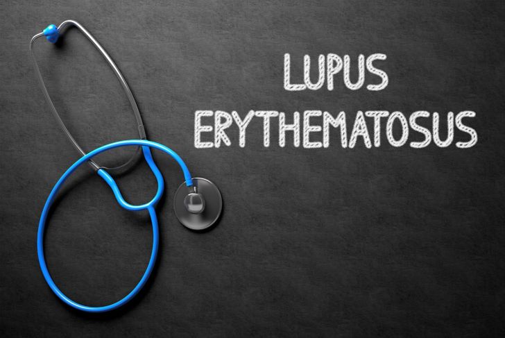 Facts About Lupus