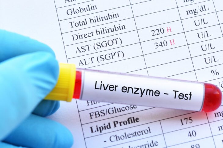 Foods for Elevated Liver Enzymes Levels