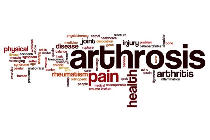 Frequently Asked Questions about Arthrosis