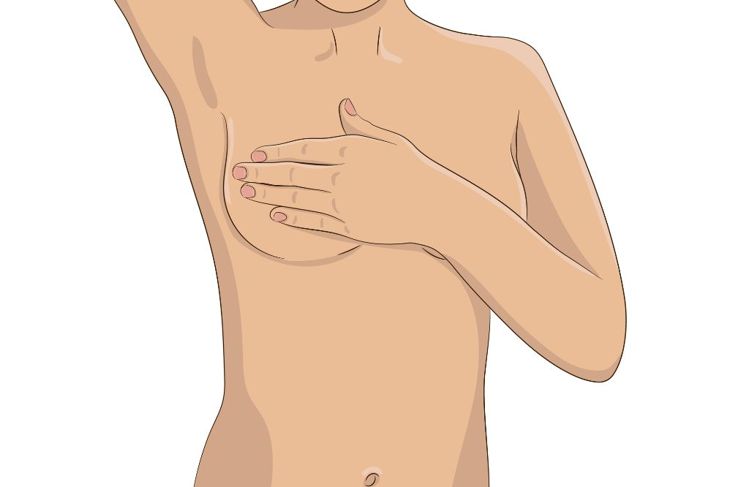 Frequently Asked Questions About Breast Lumps