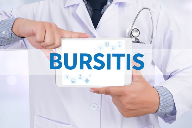 Frequently Asked Questions about Bursitis of the Hip