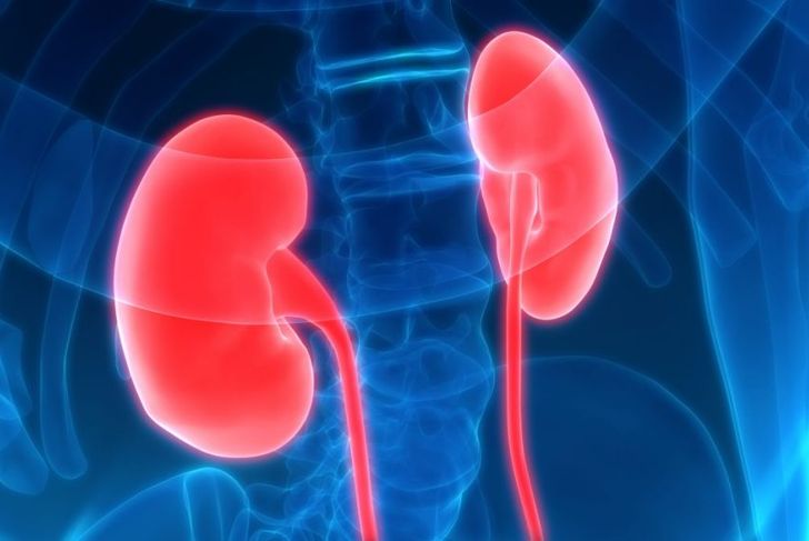 Frequently Asked Questions About Chronic Kidney Disease