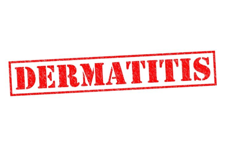 Frequently Asked Questions About Contact Dermatitis