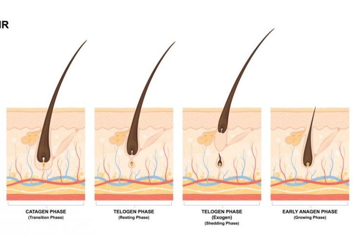 Frequently Asked Questions About Diffuse Hair Loss