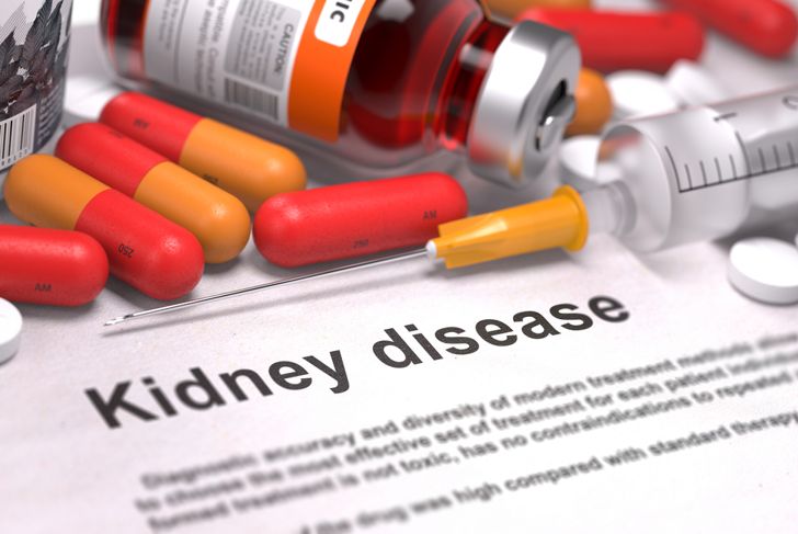 Frequently Asked Questions about Nephritis
