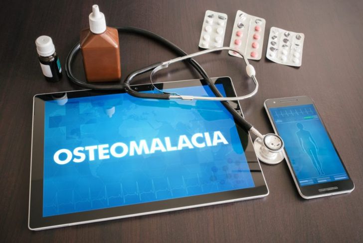 Frequently Asked Questions About Osteomalacia