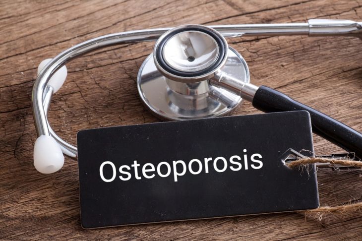 Frequently Asked Questions About Osteopenia