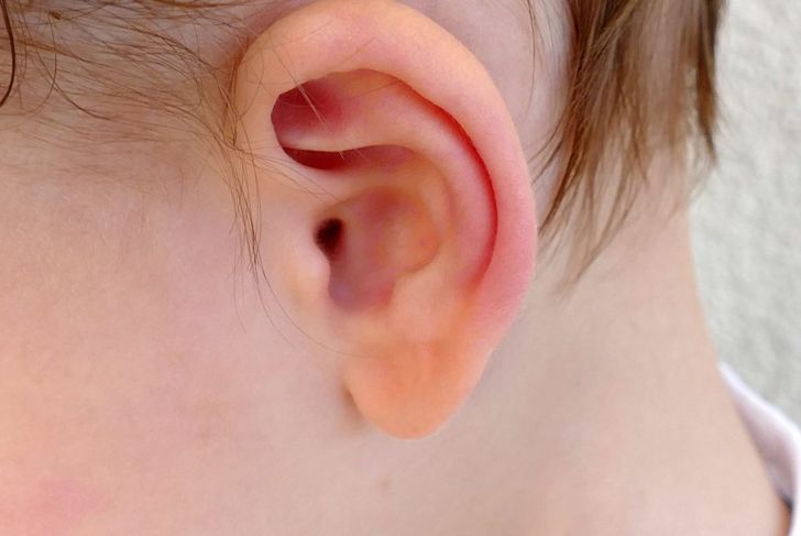 Frequently Asked Questions About Otitis Externa