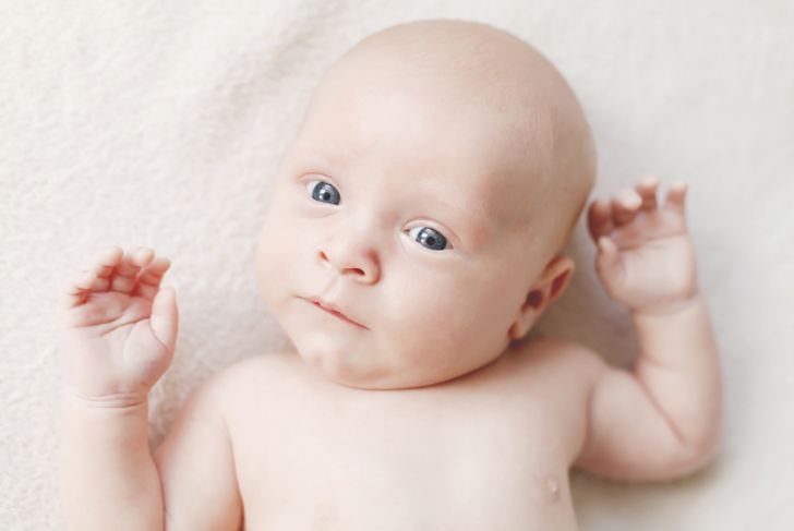 Frequently Asked Questions about Torticollis